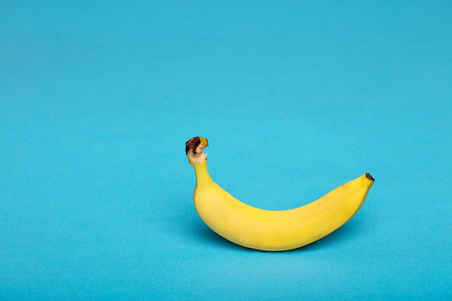 zasto su banane dobre