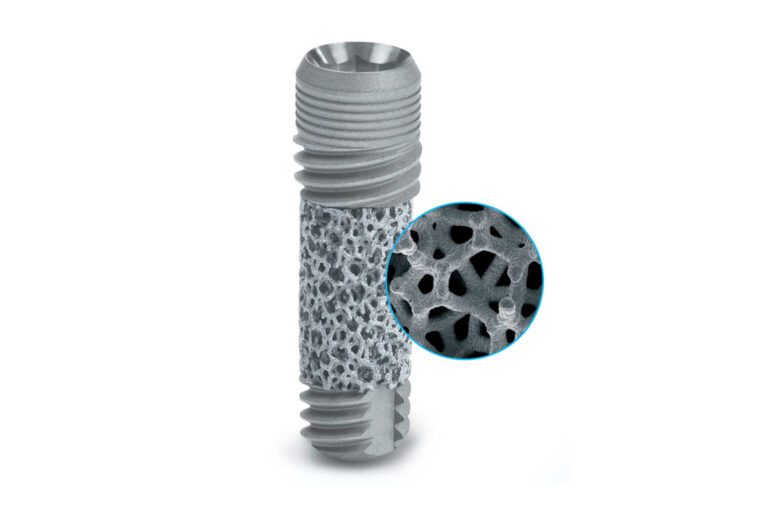 zimmer zubni implantati 1 768x512
